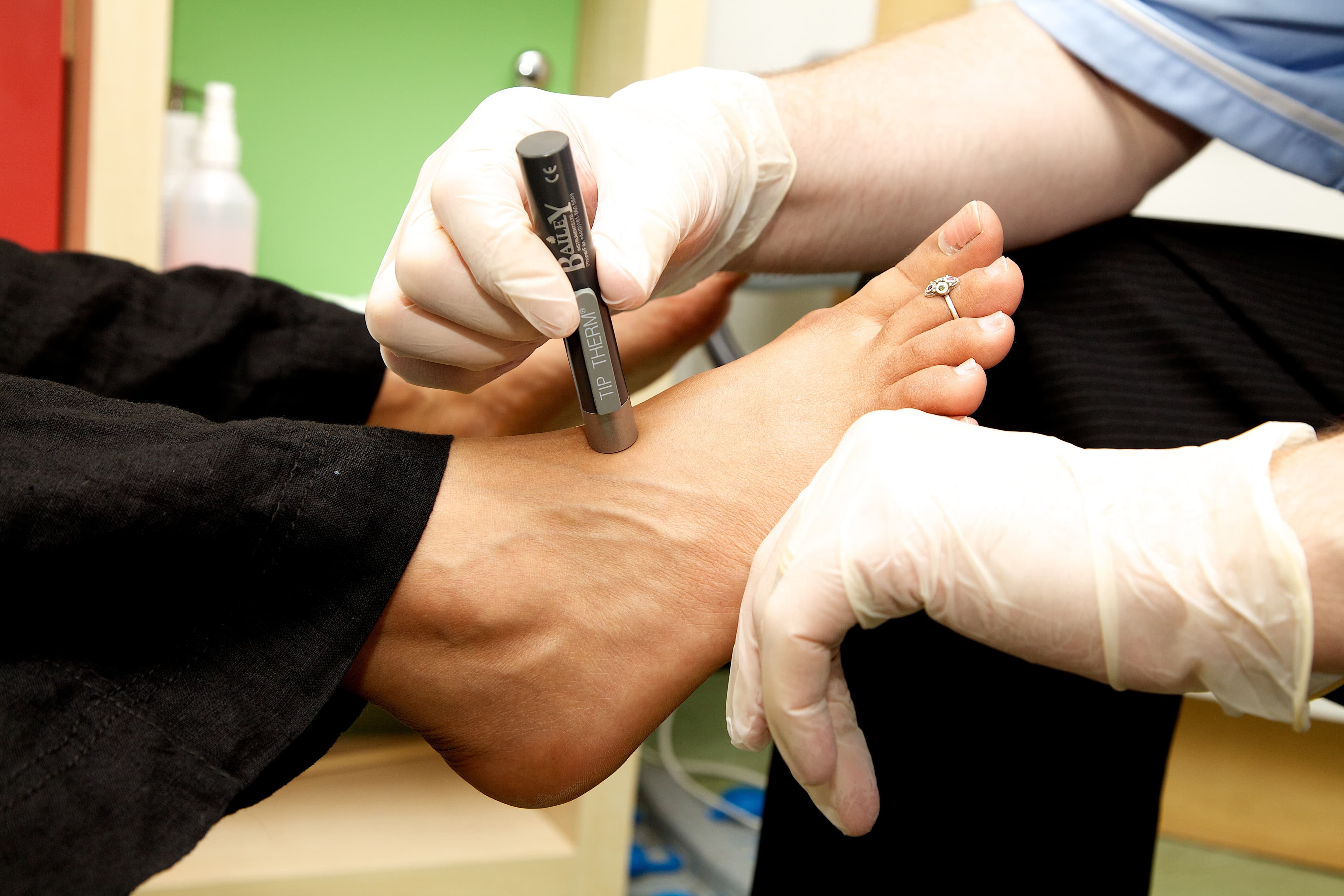 Medical professional using a Tip Therm device to test temperature sensitivity on a patient's foot.